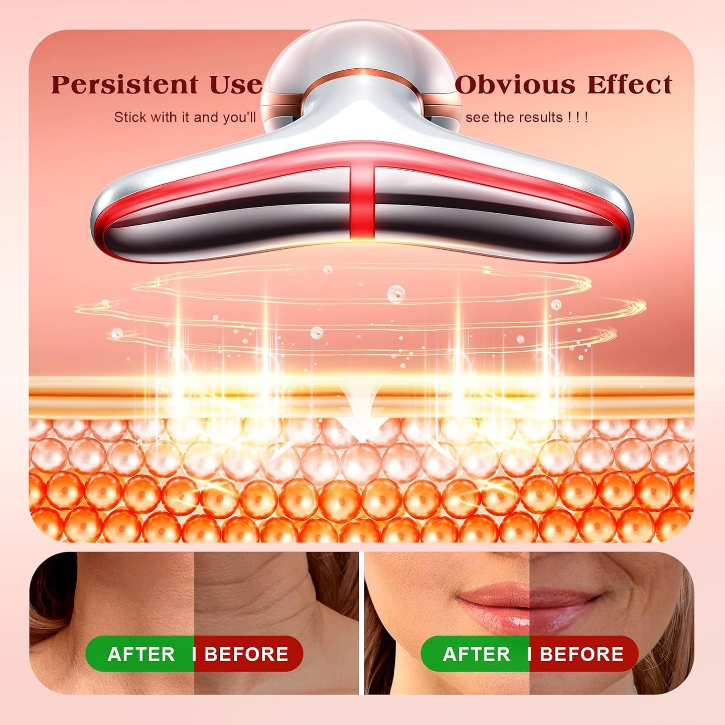 7-Color LED Thermal Facial Sculptor